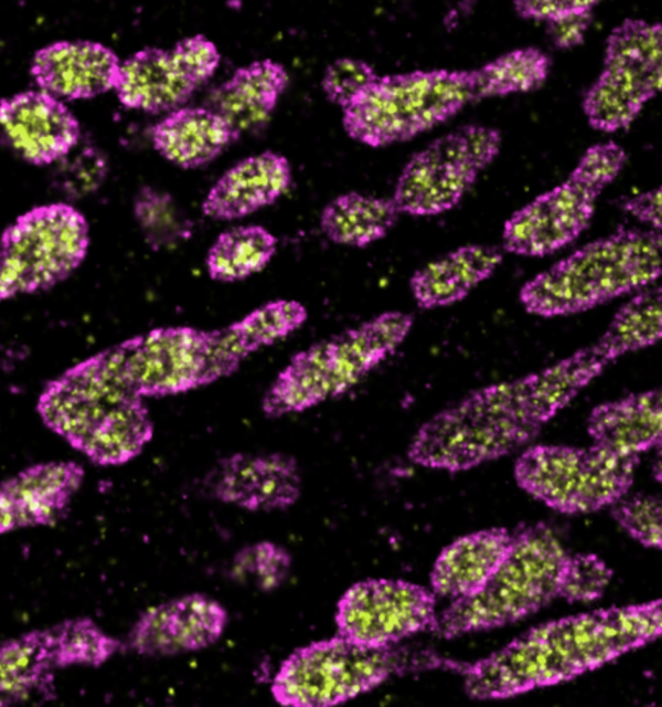 HSP60 and TOM 20 stained.