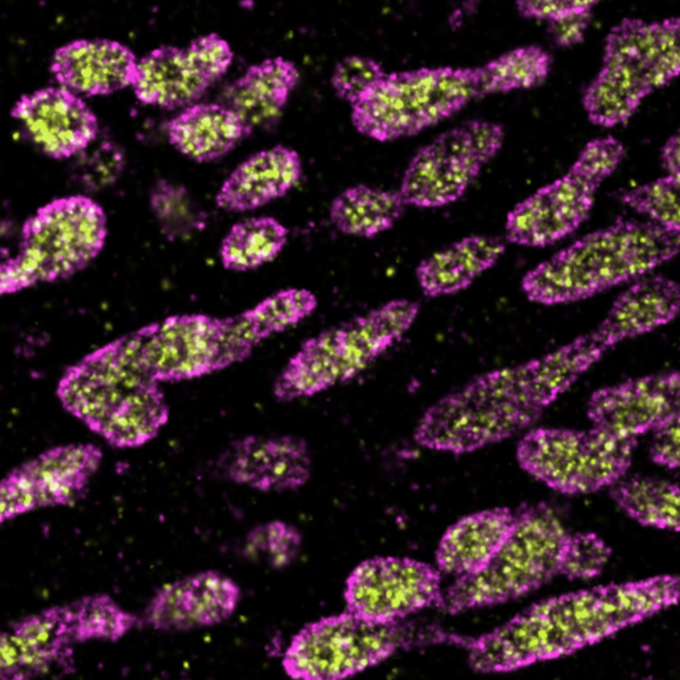 HSP60 and TOM 20 stained.