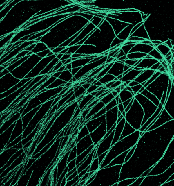 Microtubules stained