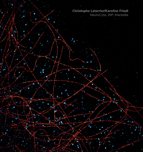 Microtubules and clathrin stained with MASSIVE-AB 2-PLEX by Christophe Leterrier/Karoline Friedl, NeuroCyto, INP, Marseille