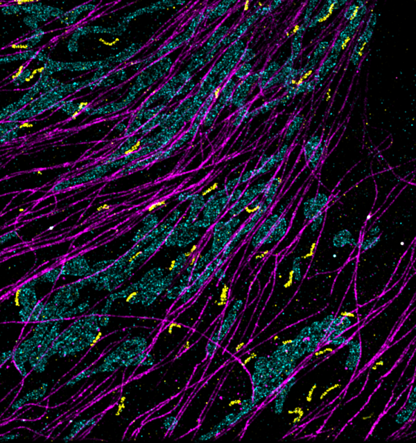 Microtubles. TOM20 and PMP70 stained with MASSIVE-AB 2-PLEX kit